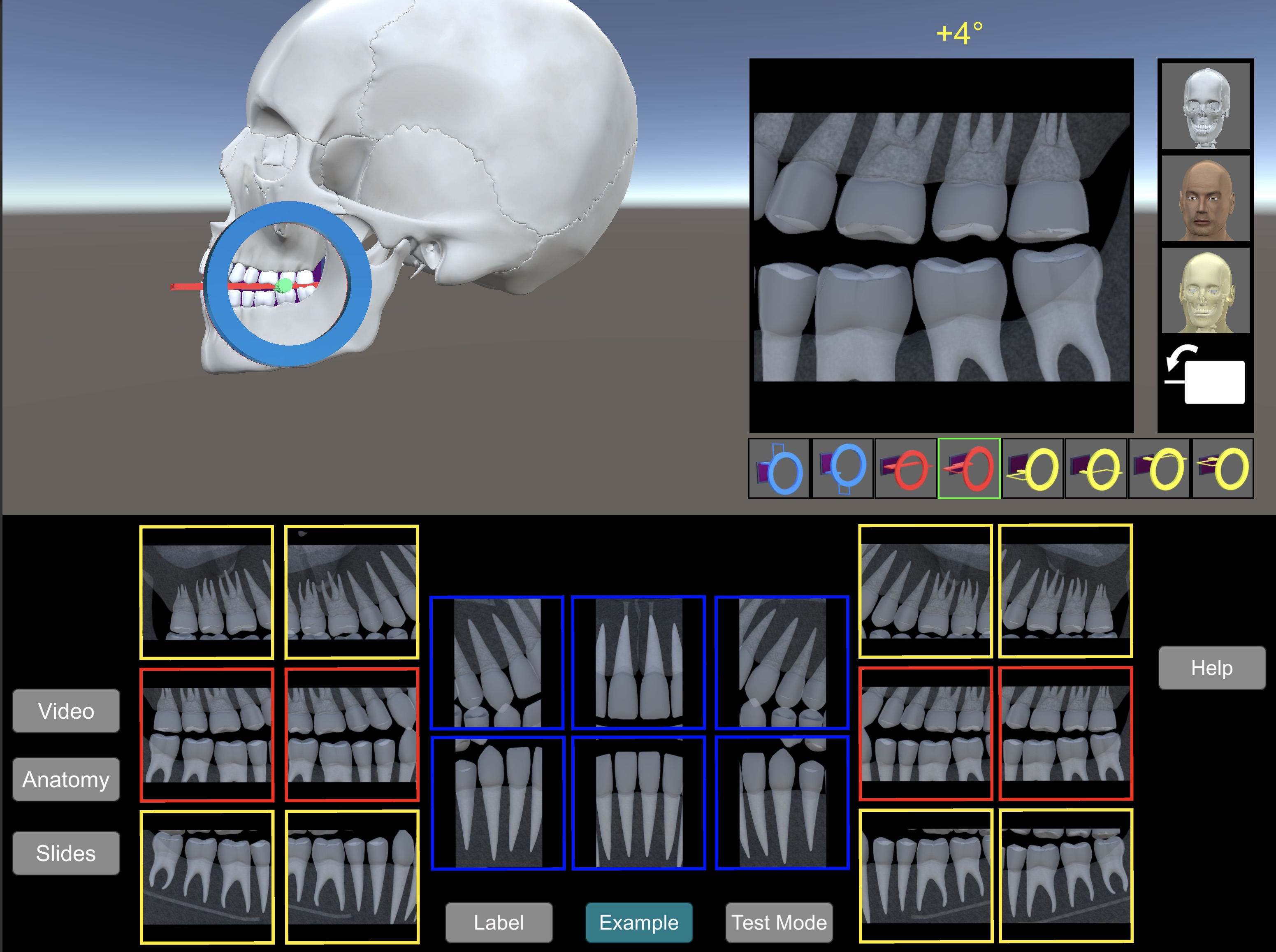 Immersive Dental Systems